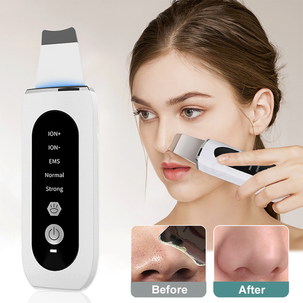 Shovel Skin Blackhead Ultrasonic Beauty Microcurrent Color Light - My Store